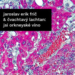 ČVACHTAVÝ LACHTAN - Ropa / Jsi orkneyské víno - 2CD