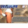 112 Vakuový přístroj pro redukci celulitidy CELLULIFE