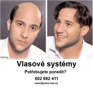 Vlasový systém - Integrace vlasů na zakázku