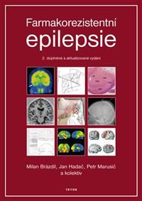 Farmakorezistentni epilepsie