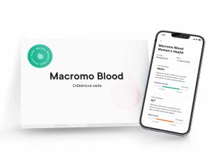 Macromo Krevní test žena  – játra, štítná žláza, srdce i cukrovka  7 Výsledků