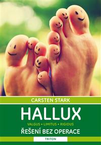 Hallux: řešení bez operace