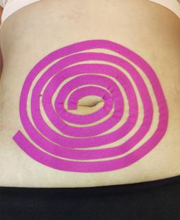 Online kurz Dr.Nek slim tejpování na zeštíhlení břicha a boků