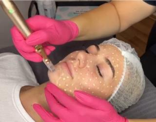 Prezenční kurz BB Glow BB glow prezenční kurz vč příslušenství: BB glow prezenční kurz vč příslušenství a Dr.Nek derma pen