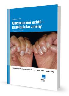 Kniha Onemocnění nehtů-patologické změny