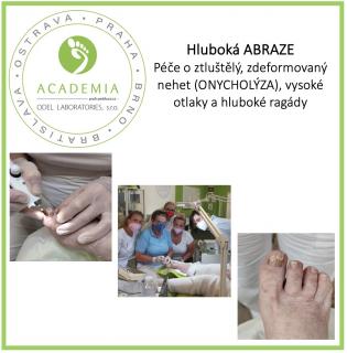 Kurz – Hluboká ABRAZE – péče o ztluštělý, zdeformovaný nehet (ONYCHOLÝZA), vysoké otlaky a hluboké ragády Město: Praha, Datum: 10.07.2025, 13:00 -…