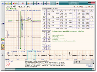 Modul Interpretace a rozměření pro EKG SEIVA Praktik