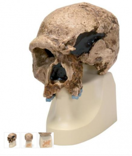Anthropological Skull Model - Steinheim (Anatomické modely)