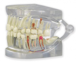 Jasný model lidské čelisti se zuby (Anatomické modely)