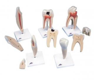 Klasický model zubů, 5 modelů (Anatomické modely)