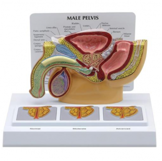 Model mužské pánve s 3D prostatou (Anatomické modely)