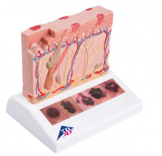 Model rakoviny kůže (Anatomické modely)