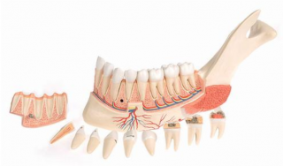 Pokročilá poloviční dolní čelist s 8 nemocnými zuby, 19 částí (Anatomické modely)
