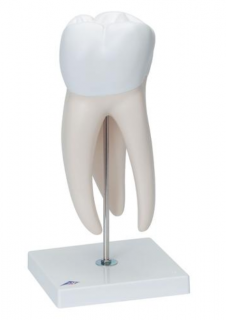 Velká stolička s dentálními dutinami, 15krát životní velikost, 6 dílů (Anatomické modely)