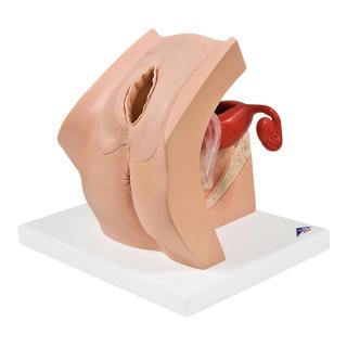 Gynekologický výukový model