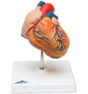 Klasický model srdce s hypertrofií levé komory, 2 části