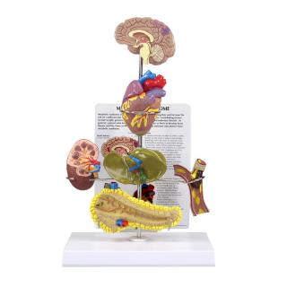 Model metabolického syndromu