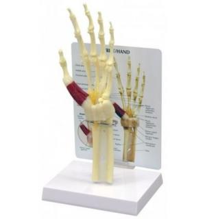 Model ruky a zápěstí se syndromem karpálních tunelů