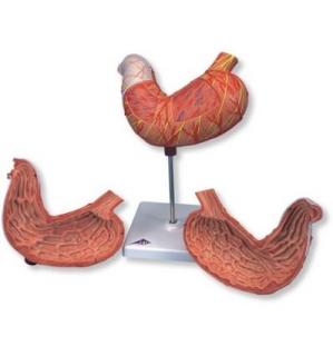Model žaludku, 2 části