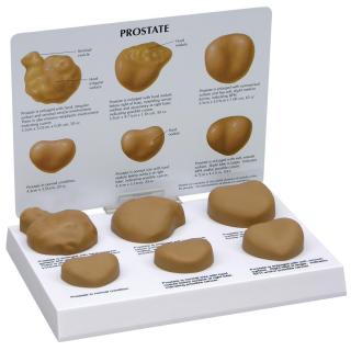 Sada anatomických modelů prostaty