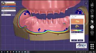 Exocad - CAD software Modul: Full denture