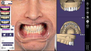 Exocad - CAD software Modul: Jaw Motion