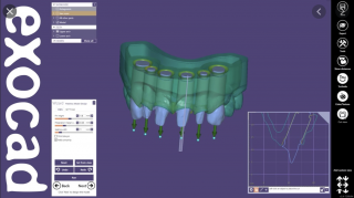 Exocad - CAD software Modul: Model creator